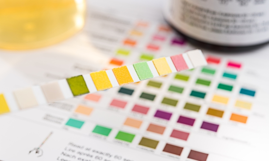 uninanalysis test results 