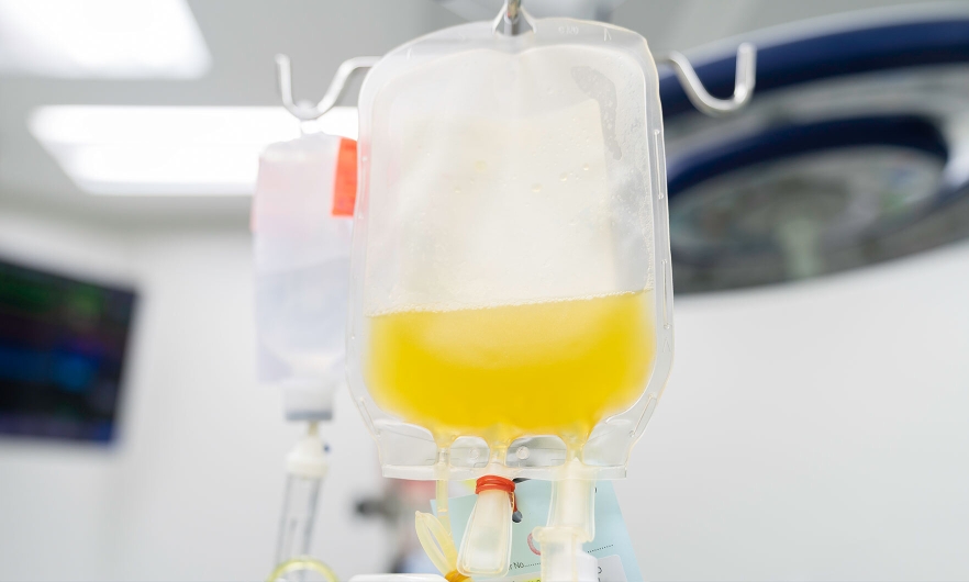 IV bag containing plasma