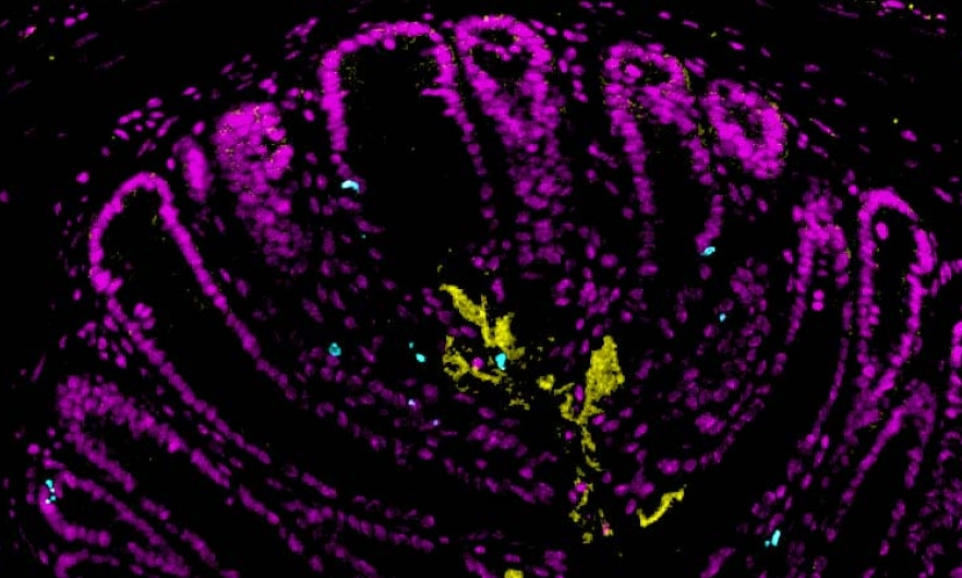 colorful microscopy image of mouse colon tissue section: pink host cells outline villi against black background, with clumps of yellow at the center and scattered blue dots