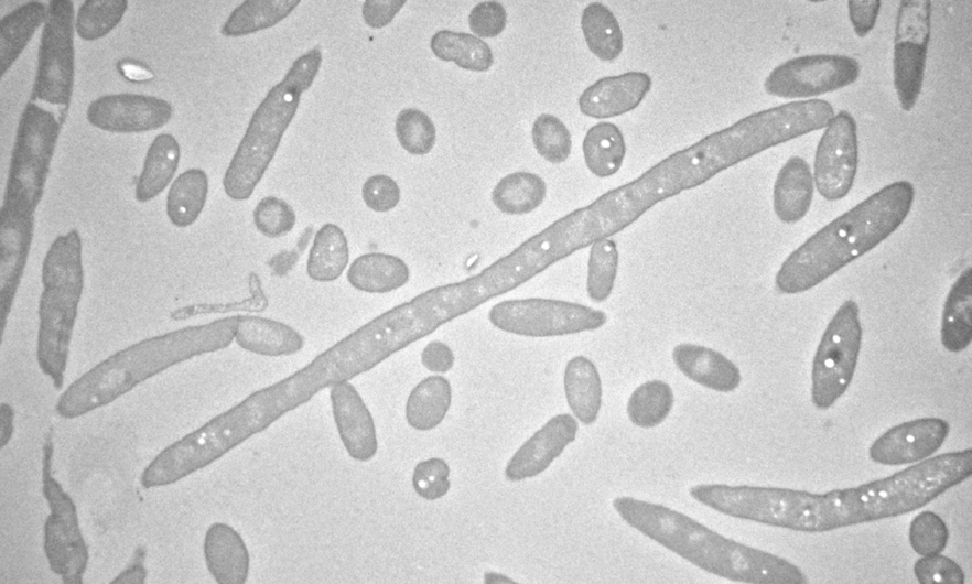 Transmission electron microscope image of Delftia tsuruhatensis.