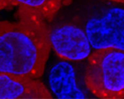 microscopy image of cells: bright blue blobs, some inside larger red blobs