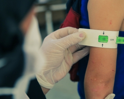 Undernourished child getting arm measured