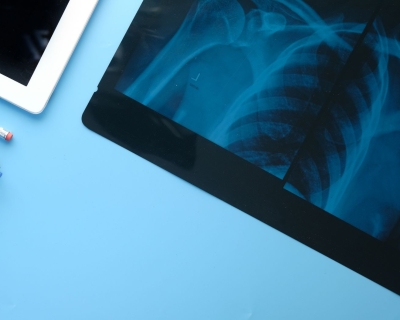 An x-ray of a human upper body skeleton on an tablet.