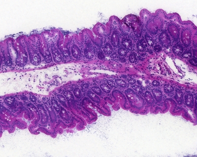 Microscope section showing 622A_cecum through a healthy mouse cecum stained with Haematoxylin-eosin