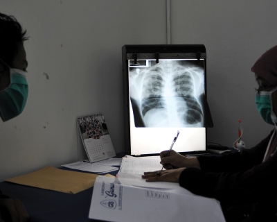 Doctor Yulismar (R) checks the condition of a tuberculosis patient at the Indonesian Association Against Tuberculosis in Jakarta, March 24, 2016. Jefri Tarigan /Anadolu Agency/Getty