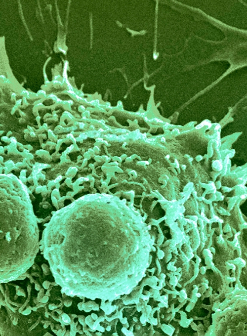 Green microscopy image of roughly spherical T lymphocytes attaching to large, irregularly shaped cancer cells