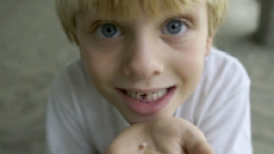 Child with lost tooth