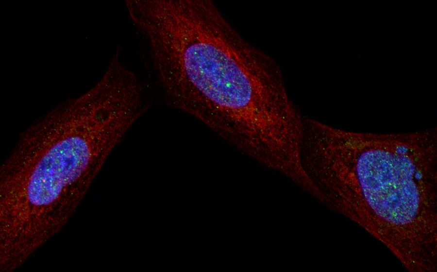 Microscopy image of three cells: mottled blue oval centers surrounded by red strands stretching to fill the cell, speckled with tiny green dots, on a black background  