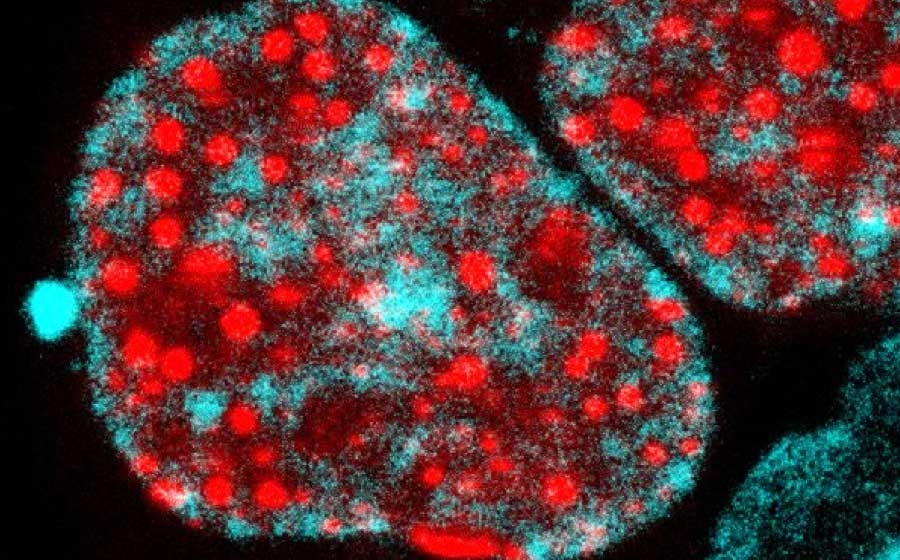 colorful microscopy image of cells, with many dense red dots and more diffuse blobs of blue