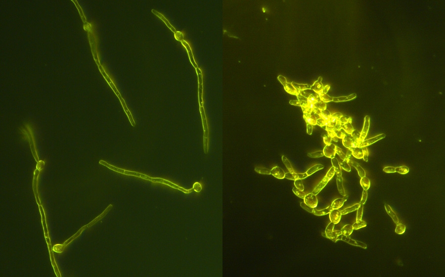 fluorescent yellow fungal cells on black background: on left, a few very long cells spread out, right: clump of many shorter cells