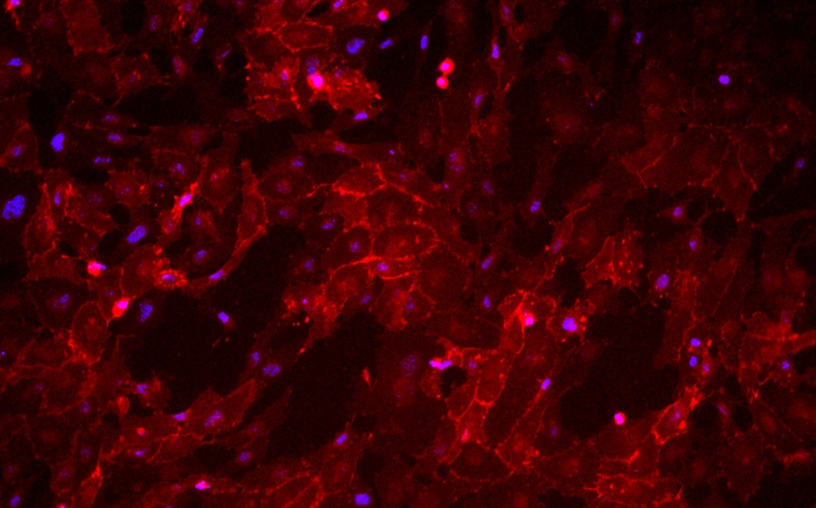 A field of red-stained cells with blue spots near the centers