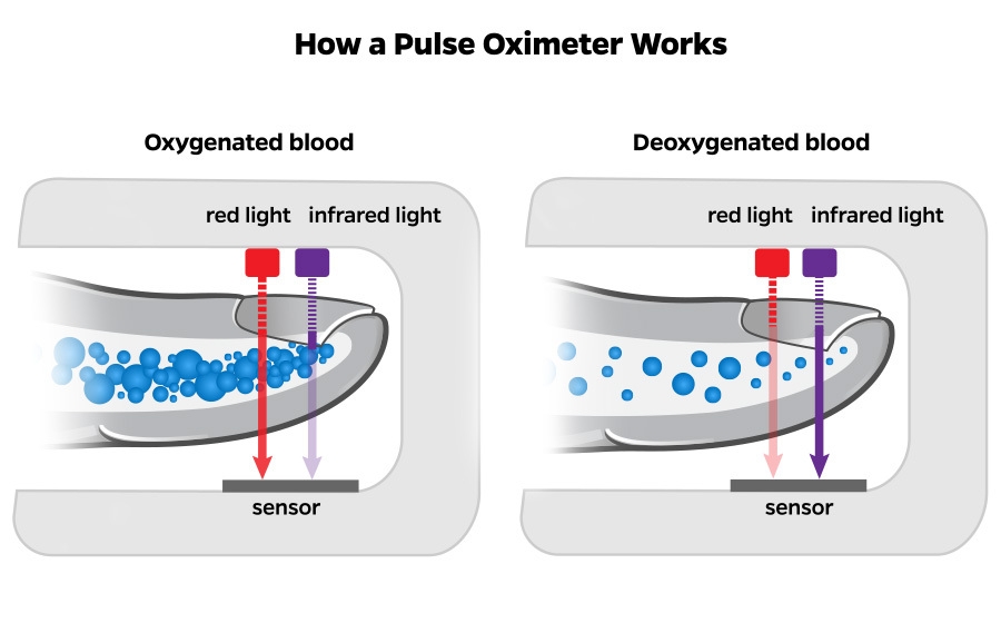 How a Pulse Oximeter Works Side-by-side diagram of pulse oximeter function on oxygenated blood versus deoxygenated blood.