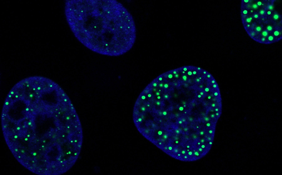 Fluorescent blue cells sit on a black background. The cells are dotted with bright green spots - one cell has a few sparse pinpricks of green, others are filled with larger dots.