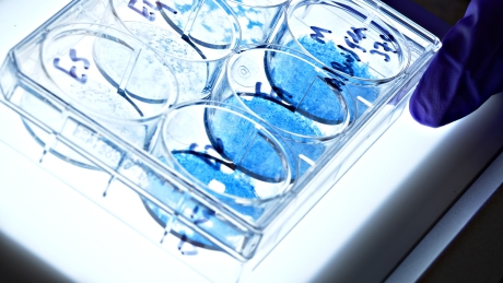 Petri dishes with samples for lab testing A series of petri dishes with samples for testing