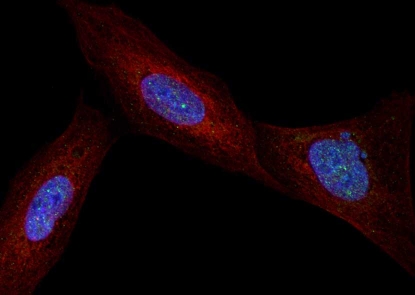 Microscopy image of three cells: mottled blue oval centers surrounded by red strands stretching to fill the cell, speckled with tiny green dots, on a black background  