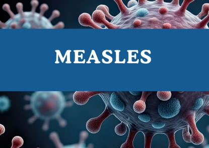 Measles