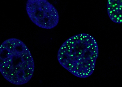Fluorescent blue cells sit on a black background. The cells are dotted with bright green spots - one cell has a few sparse pinpricks of green, others are filled with larger dots.